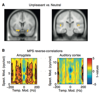 Illustration for article titled How a Human Scream Uniquely Activates the Fear Response in Your Brain